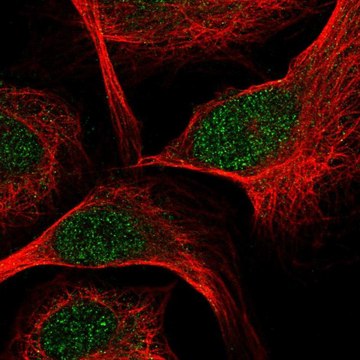 Anti-TCF7 antibody produced in rabbit
