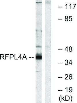 Anti-RFPL4A antibody produced in rabbit