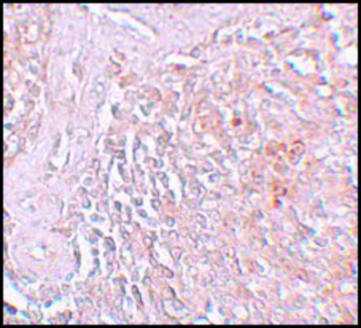 Anti-ZIP8 antibody produced in rabbit