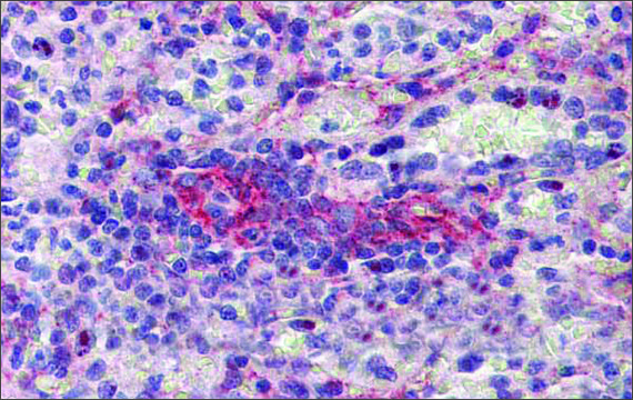 Anti-SEPT11 antibody produced in rabbit