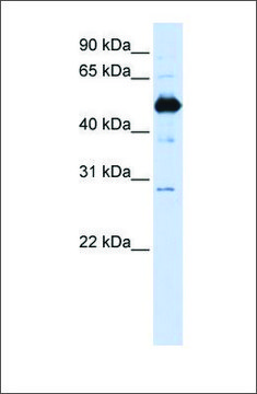 Anti-FAM134B antibody produced in rabbit