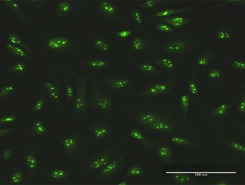 Anti-SMARCA5 antibody produced in rabbit