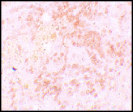Anti-HVCN1 antibody produced in rabbit