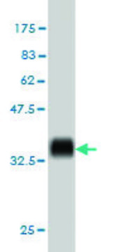 ANTI-KIT antibody produced in mouse