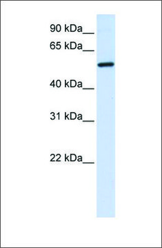 Anti-ALAS2 (ab2) antibody produced in