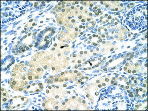 Anti-SMARCE1 antibody produced in rabbit