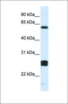 Anti-HABP2 antibody produced in rabbit