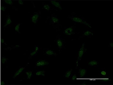 Monoclonal Anti-TTF2 antibody produced in