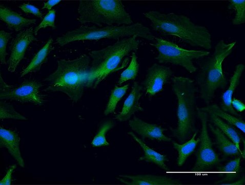 Anti-ANKMY1 antibody produced in mouse