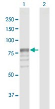 Anti-GUSB antibody produced in rabbit
