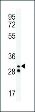 ANTI-NEUTROPHIL ELASTASE(N-TERMINAL) antibody produced in