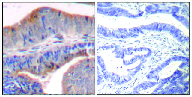 Anti-STMN1 (Ab-62) antibody produced in