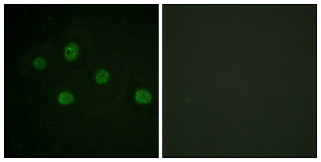 Anti-DNA-PK antibody produced in rabbit