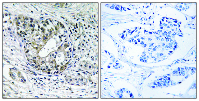 Anti-PNPT1 antibody produced in rabbit