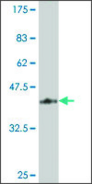 ANTI-TIE1 antibody produced in mouse