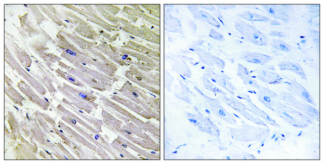 Anti-MRPL16 antibody produced in rabbit