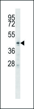 ANTI-ZDHHC6 (C-TERM) antibody produced in