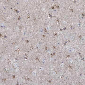 Anti-FAM210A antibody produced in rabbit