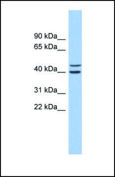 Anti-FBXL14, (N-terminal) antibody produced in