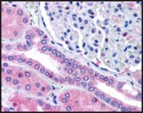 Anti-RHPN2 antibody produced in goat