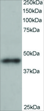 Anti-ARP1 homolog B antibody produced