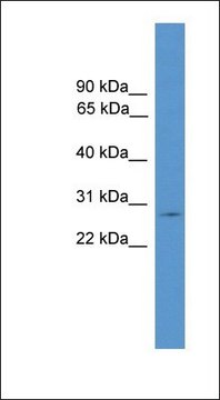 Anti-CLRN1 antibody produced in rabbit