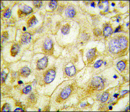 Anti-EDA (center) antibody produced in