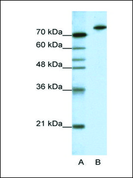 Anti-KLHL3 antibody produced in rabbit