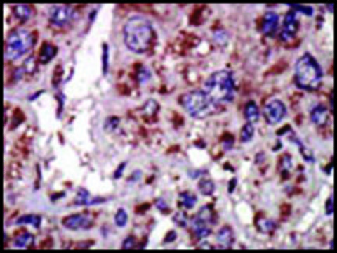 Anti-DGKA (C-term) antibody produced in