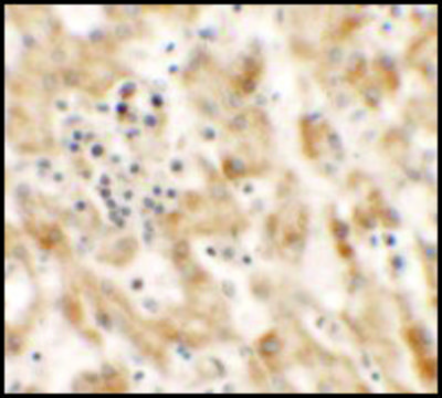 Anti-NKX2-8 antibody produced in rabbit