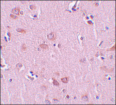 Anti-PLEKHM2 antibody produced in rabbit