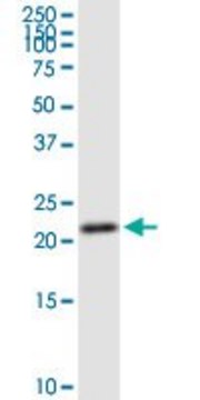 Anti-GINS1 antibody produced in rabbit