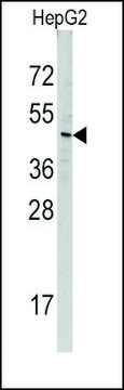 Anti-MIPEP (center) antibody produced in