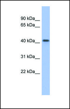 Anti-FIZ1 antibody produced in rabbit