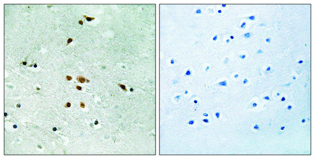 Anti-phospho-FER (pTyr??²) antibody produced in