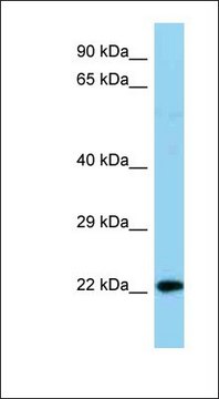 Anti-NDUFB8 antibody produced in rabbit