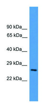 Anti-CD8A antibody produced in rabbit