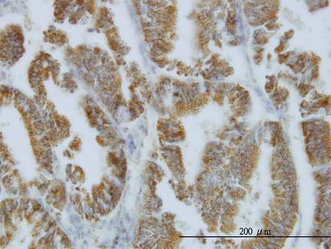 Monoclonal Anti-NODAL, (C-terminal) antibody produced