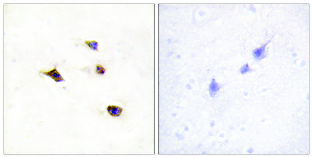 Anti-IP6K3 antibody produced in rabbit
