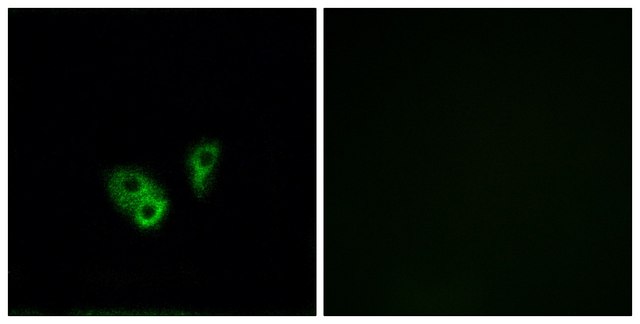 Anti-CNGA2 antibody produced in rabbit