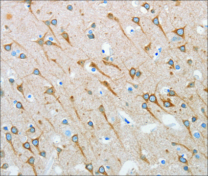 Anti-INTS1 antibody produced in rabbit