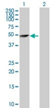 Anti-TRIM62 antibody produced in rabbit