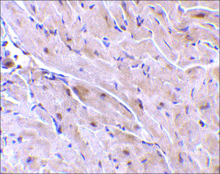 Anti-TRIAD3A antibody produced in rabbit