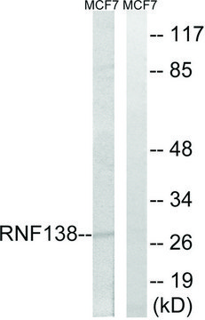 Anti-RNF138 antibody produced in rabbit