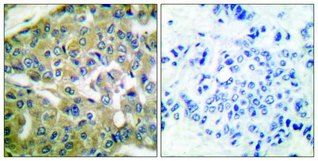 Anti-FHIT antibody produced in rabbit