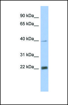 Anti-PSMA4, (N-terminal) antibody produced in