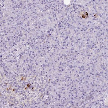 Anti-KCNJ11 antibody produced in rabbit