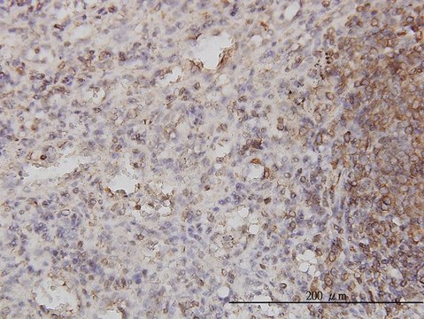 Monoclonal Anti-PSCD1 antibody produced in