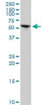 Anti-KRT6L antibody produced in mouse
