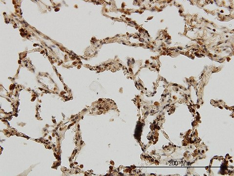 Monoclonal Anti-IRAK1, (C-terminal) antibody produced